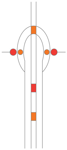 DV004