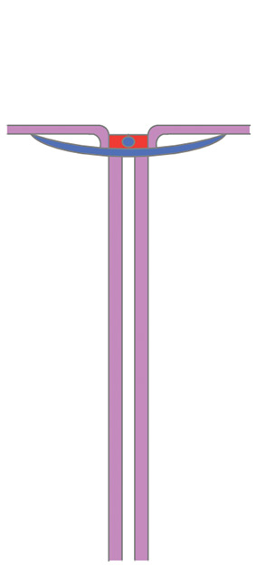 DV011